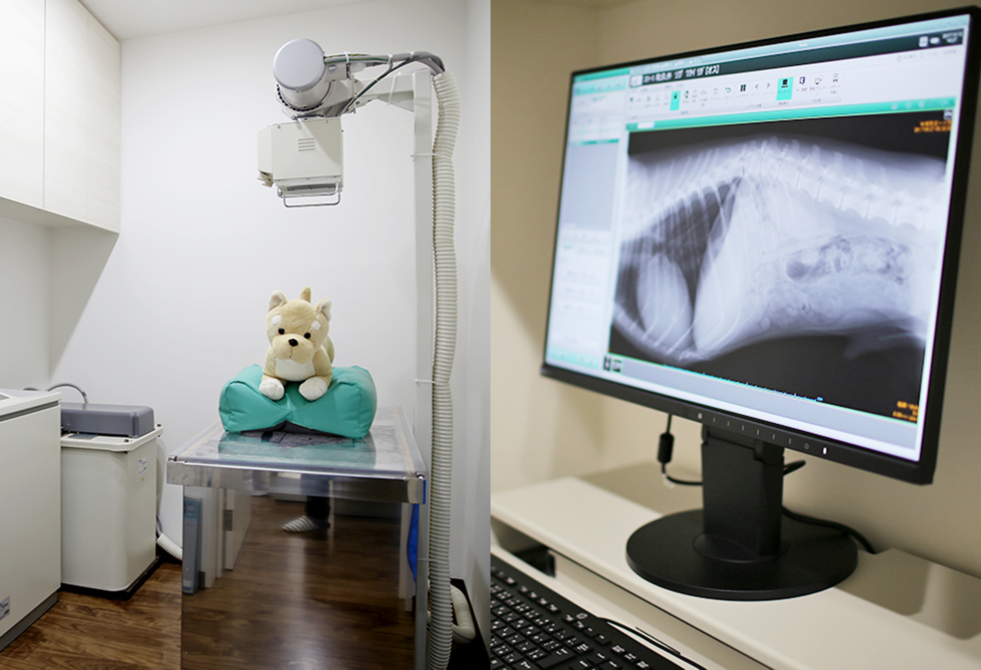 【Left: X-ray Room Right: X-ray Monitor】